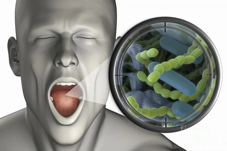 How to deal with bad breath or mouth odor (Halitosis)